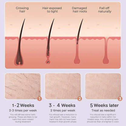 IPL Hair Removal Handset